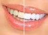انواع روش های دندانپزشکی زیبایی، روکش، کامپوزیت، لمینت، ایمپلنت و ارتودنسی
